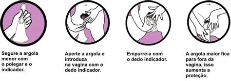 Como colocar uma camisinha corretamente: passo a passo e dicas